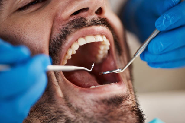 Best Emergency Dentist for Special Needs Patients in Glen Alpine, NC